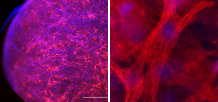 Cardiac myocytes cultured within PEG-fibrinogen hydrogels after several days; staining for α-Sarcomeric acti and DAPI