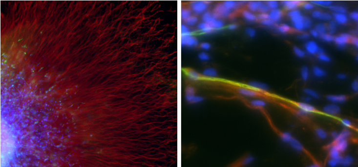 Dorsal root ganglion outgrowth into PEG-fibrinogen hydrogels after 1 week in culture; shown are neuronal cells (red) and glial cells (green)