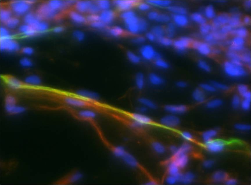 Dorsal root ganglion outgrowth into PEG-fibrinogen hydrogels after 1 week in culture; shown are neuronal cells (red) and glial cells (green)